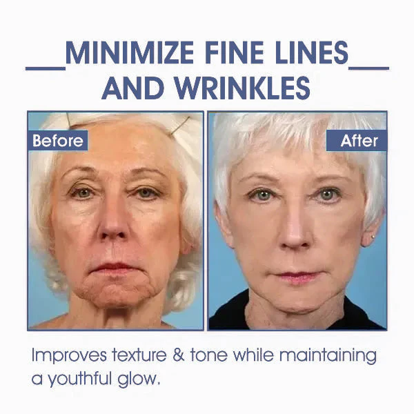 ⭐ Unwrap the Savings! Fubsta® Firming Cream Christmas Special: Take 75% OFF! 🎁 - Image 10