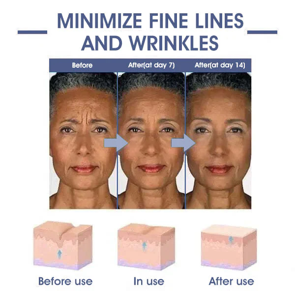 ⭐ Unwrap the Savings! Fubsta® Firming Cream Christmas Special: Take 75% OFF! 🎁 - Image 11