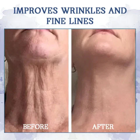 ⭐ Unwrap the Savings! Fubsta® Firming Cream Christmas Special: Take 75% OFF! 🎁 - Image 4