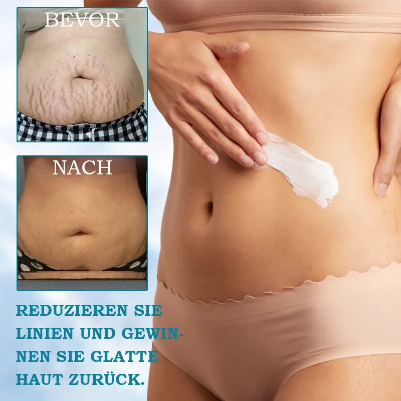 ⭐ Unwrap the Savings! Fubsta® Firming Cream Christmas Special: Take 75% OFF! 🎁 - Image 5