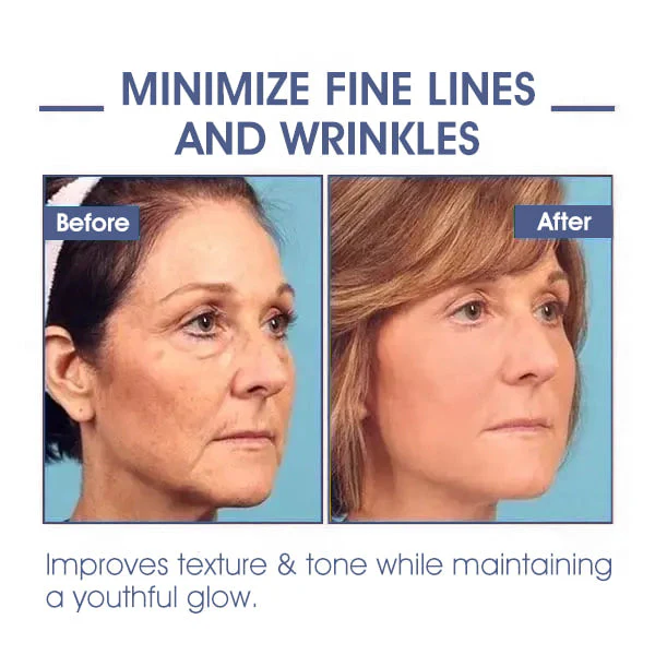 ⭐ Unwrap the Savings! Fubsta® Firming Cream Christmas Special: Take 75% OFF! 🎁 - Image 6