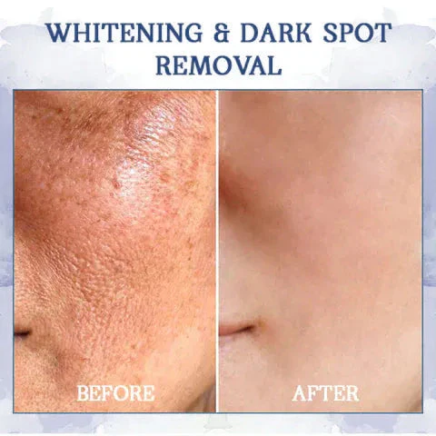 ⭐ Unwrap the Savings! Fubsta® Firming Cream Christmas Special: Take 75% OFF! 🎁 - Image 9