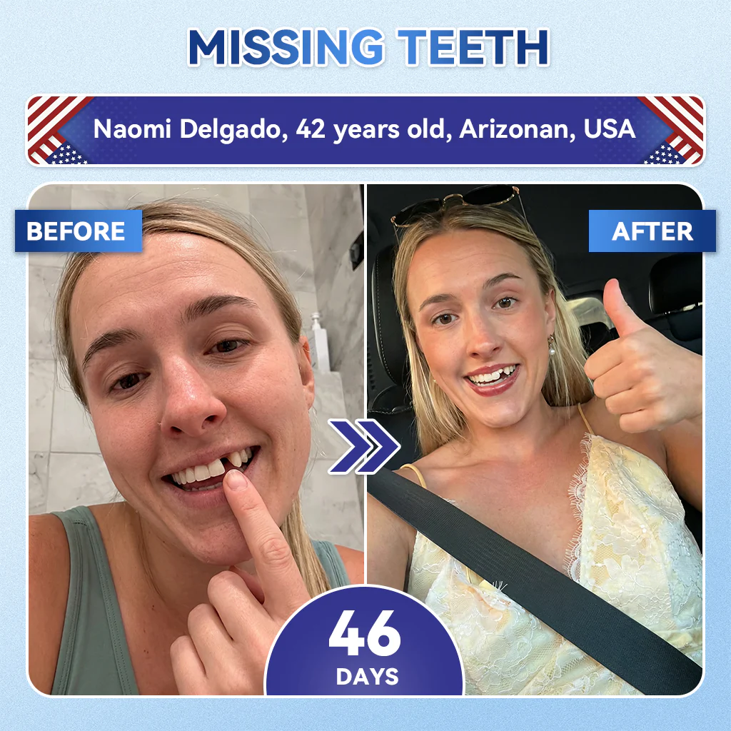 ใ๐๐๐๐ข๐๐ข๐๐ฅ ๐๐ ๐๐ญ๐จ๐ซ๐ ใZUEETยฎ ๐ฆท Tideglusib FastโDissolving Tooth & Gum Repair Oral Strips โจ (Supports tooth repair and helps relieve gum discomfort and other common oral concerns) - Image 7